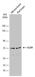 Anti-GLB1 antibody used in Western Blot (WB). GTX134513