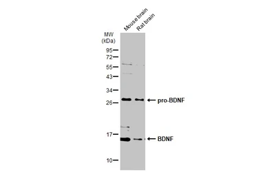 Anti-BDNF antibody used in Western Blot (WB). GTX134514