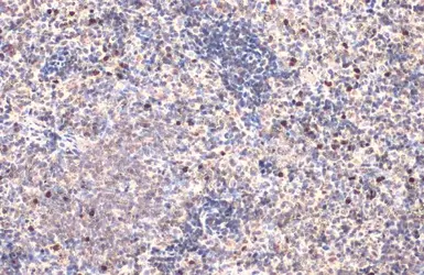 Anti-CTLA4 antibody used in IHC (Paraffin sections) (IHC-P). GTX134527