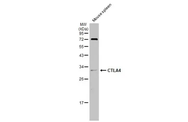Anti-CTLA4 antibody used in Western Blot (WB). GTX134527