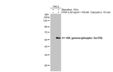 Anti-IKK gamma (phospho Ser376) antibody used in Western Blot (WB). GTX134550