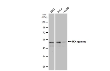Anti-IKK gamma antibody used in Western Blot (WB). GTX134575