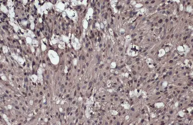 Anti-IKK gamma antibody used in IHC (Paraffin sections) (IHC-P). GTX134575