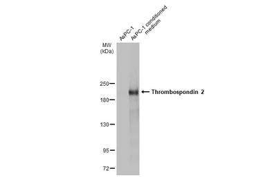Anti-Thrombospondin 2 antibody used in Western Blot (WB). GTX134576