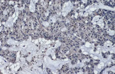 Anti-Thrombospondin 2 antibody used in IHC (Paraffin sections) (IHC-P). GTX134576