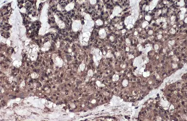 Anti-Caspase 8 p10 antibody used in IHC (Paraffin sections) (IHC-P). GTX134589