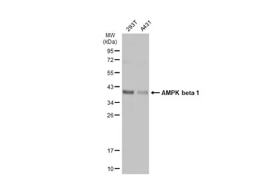 Anti-AMPK beta 1 antibody used in Western Blot (WB). GTX134594