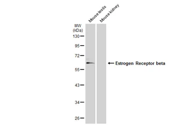 Anti-Estrogen Receptor beta antibody used in Western Blot (WB). GTX134663