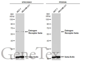 Anti-Estrogen Receptor beta antibody used in Western Blot (WB). GTX134663