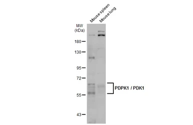 Anti-PDPK1 / PDK1 antibody used in Western Blot (WB). GTX134679