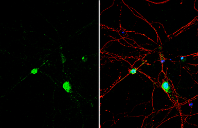 Anti-Histamine antibody used in Immunocytochemistry/ Immunofluorescence (ICC/IF). GTX134710