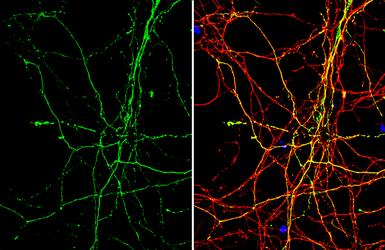 Anti-beta Alanine antibody used in Immunocytochemistry/ Immunofluorescence (ICC/IF). GTX134715