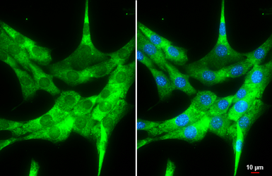 Anti-FMRP antibody used in Immunocytochemistry/ Immunofluorescence (ICC/IF). GTX134725