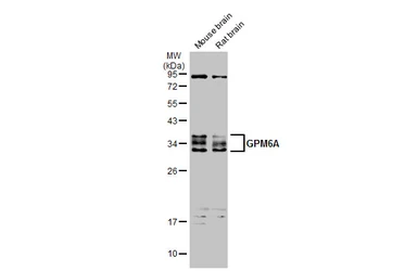 Anti-GPM6A antibody used in Western Blot (WB). GTX134740