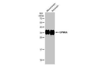 Anti-GPM6A antibody used in Western Blot (WB). GTX134741