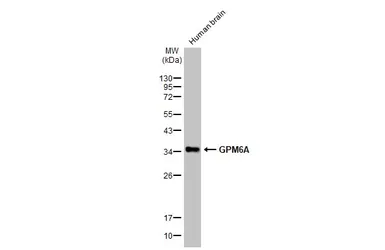 Anti-GPM6A antibody used in Western Blot (WB). GTX134741