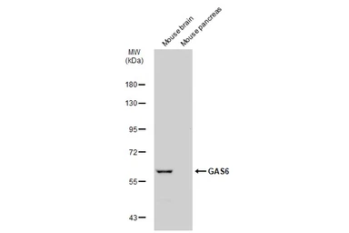 Anti-GAS6 antibody used in Western Blot (WB). GTX134747