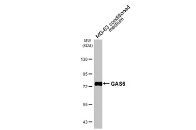 Anti-GAS6 antibody used in Western Blot (WB). GTX134747