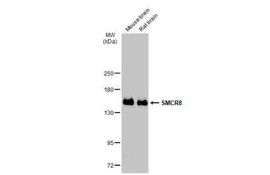 Anti-SMCR8 antibody used in Western Blot (WB). GTX134771
