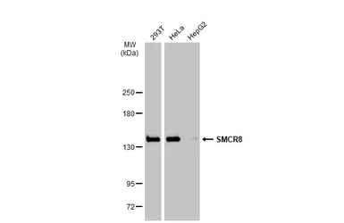 Anti-SMCR8 antibody used in Western Blot (WB). GTX134771