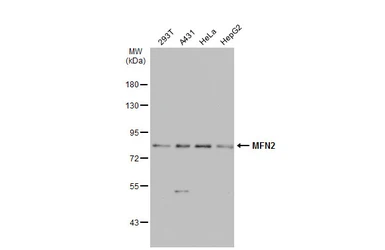 Anti-MFN2 antibody used in Western Blot (WB). GTX134774