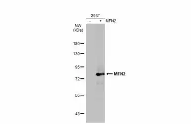 Anti-MFN2 antibody used in Western Blot (WB). GTX134774