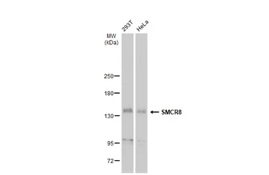 Anti-SMCR8 antibody used in Western Blot (WB). GTX134785