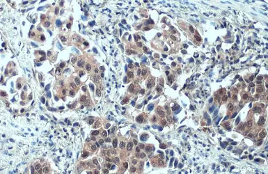 Anti-SMCR8 antibody used in IHC (Paraffin sections) (IHC-P). GTX134785