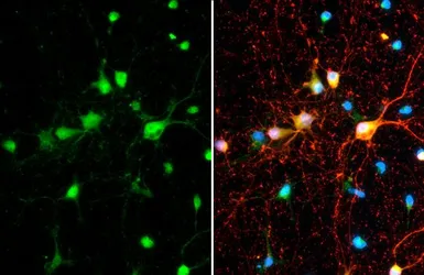 Anti-SMCR8 antibody used in Immunocytochemistry/ Immunofluorescence (ICC/IF). GTX134785