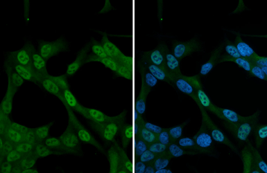 Anti-SMN1 antibody used in Immunocytochemistry/ Immunofluorescence (ICC/IF). GTX134791