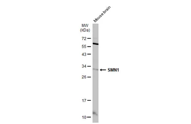 Anti-SMN1 antibody used in Western Blot (WB). GTX134791