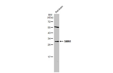 Anti-SMN1 antibody used in Western Blot (WB). GTX134791