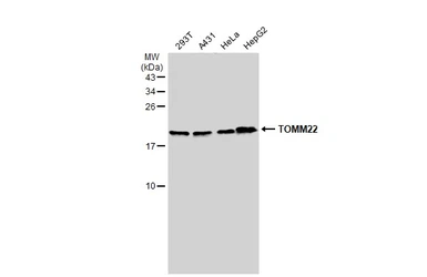 Anti-TOMM22 antibody used in Western Blot (WB). GTX134799