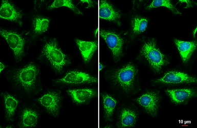 Anti-TOMM22 antibody used in Immunocytochemistry/ Immunofluorescence (ICC/IF). GTX134799