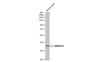 Anti-ANKRD16 antibody used in Western Blot (WB). GTX134803