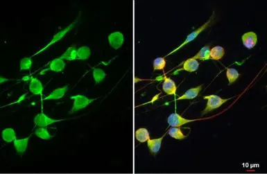Anti-ANKRD16 antibody used in Immunocytochemistry/ Immunofluorescence (ICC/IF). GTX134803