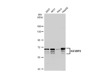 Anti-IGF2BP2 antibody used in Western Blot (WB). GTX134817
