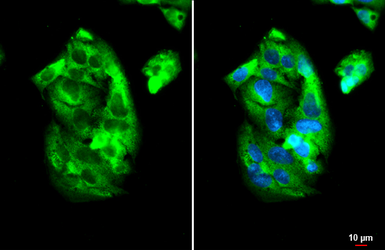 Anti-IGF2BP2 antibody used in Immunocytochemistry/ Immunofluorescence (ICC/IF). GTX134817