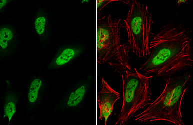 Anti-ELAVL1 / HuR antibody used in Immunocytochemistry/ Immunofluorescence (ICC/IF). GTX134821