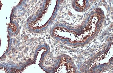 Anti-B-Raf antibody used in IHC (Paraffin sections) (IHC-P). GTX134824