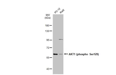 Anti-AKT1 (phospho Ser129) antibody used in Western Blot (WB). GTX134836
