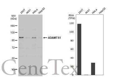 Anti-ADAMTS1 antibody used in Western Blot (WB). GTX134840