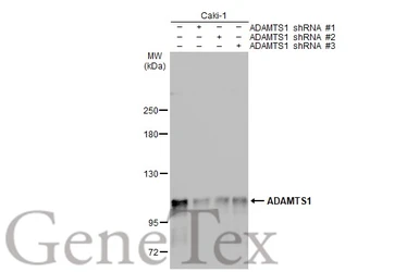 Anti-ADAMTS1 antibody used in Western Blot (WB). GTX134840