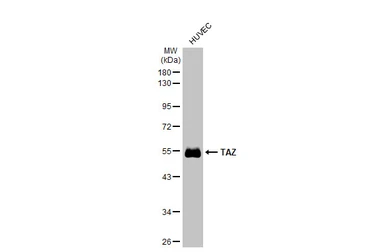 Anti-TAZ antibody used in Western Blot (WB). GTX134857
