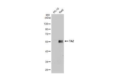 Anti-TAZ antibody used in Western Blot (WB). GTX134857