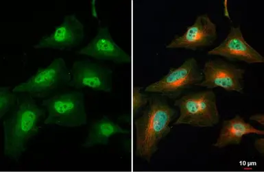 Anti-TAZ antibody used in Immunocytochemistry/ Immunofluorescence (ICC/IF). GTX134857