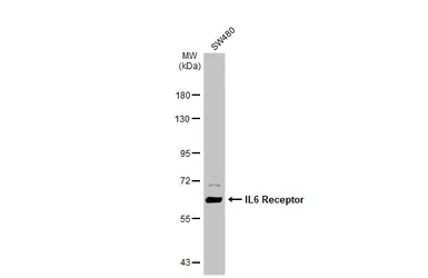 Anti-IL6 Receptor antibody used in Western Blot (WB). GTX134862