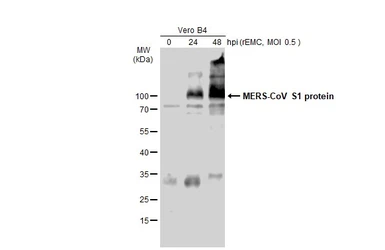 Anti-MERS-CoV Spike (S1) antibody used in Western Blot (WB). GTX134864