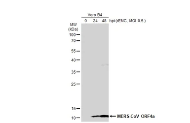 Anti-MERS-CoV ORF4a antibody used in Western Blot (WB). GTX134869