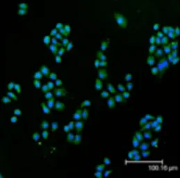 Anti-SOD1 antibody used in Immunocytochemistry/ Immunofluorescence (ICC/IF). GTX13498